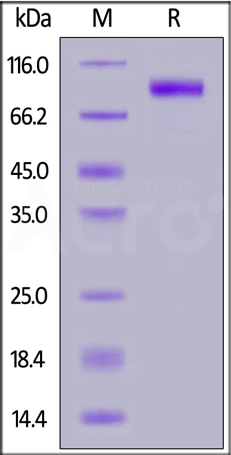 Human EGFRvIII, Fc Tag (Cat. No. EGI-H5255) SDS-PAGE gel