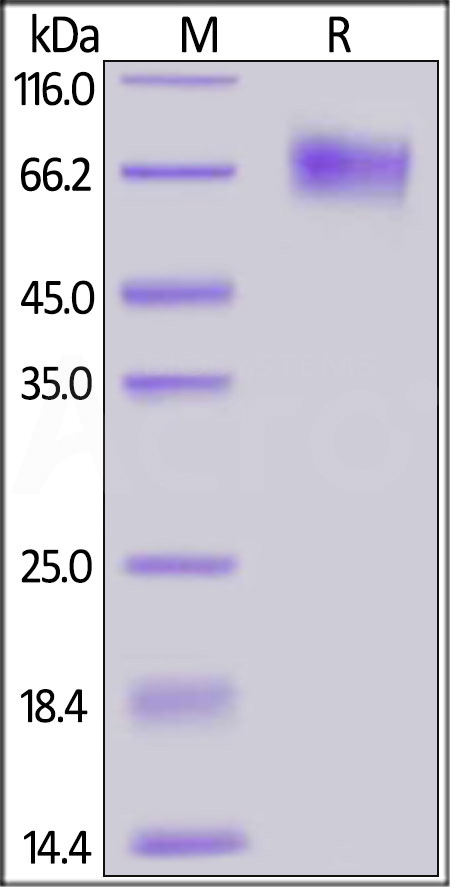 Human EGFRvIII, His Tag (Cat. No. EGI-H52H4) SDS-PAGE gel