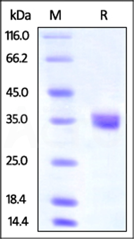 Human IGFBP-4, His Tag (Cat. No. IG4-H52E4) SDS-PAGE gel