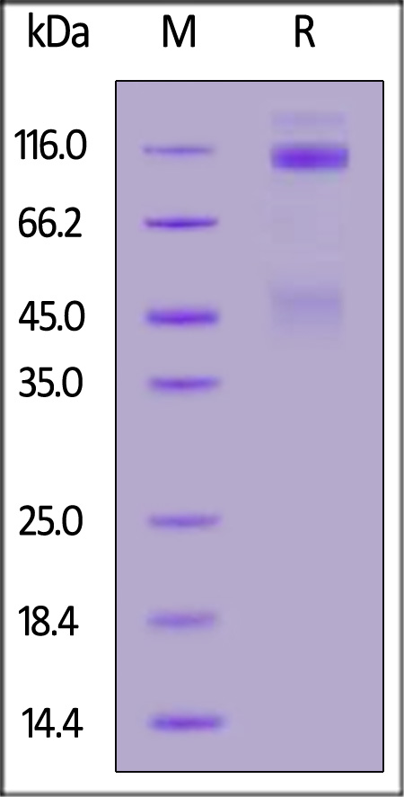 Human IGF-I R, His Tag (Cat. No. IGR-H5229) SDS-PAGE gel