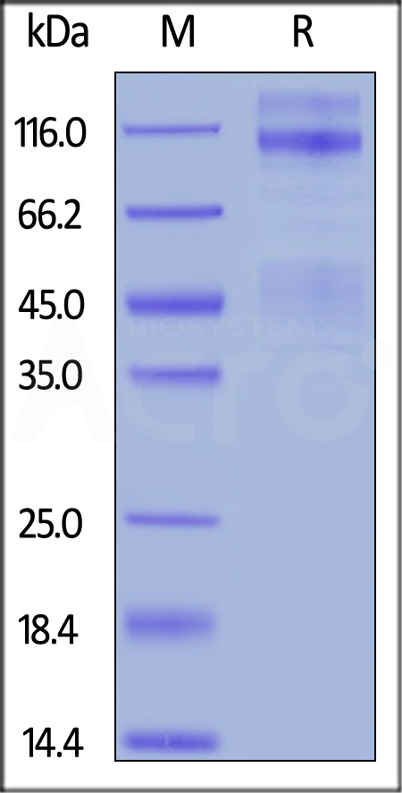 Rat IGF-I R, His Tag (Cat. No. IGR-R5224) SDS-PAGE gel