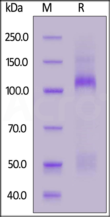Mouse IGF-I R, His Tag (Cat. No. IGR-M5223) SDS-PAGE gel