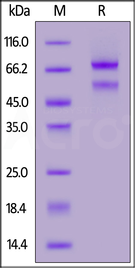 Human CTGF, Fc Tag (Cat. No. GTF-H5253) SDS-PAGE gel