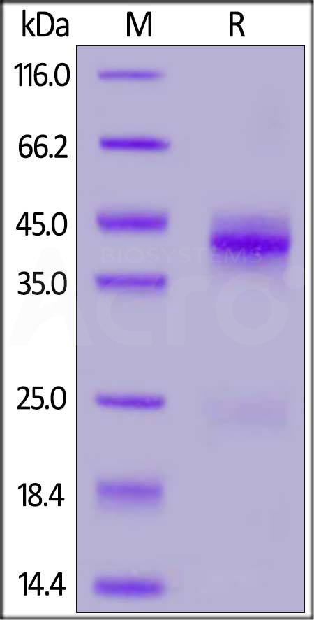 Rhesus macaque CTGF, His Tag (Cat. No. GTF-R52H4) SDS-PAGE gel