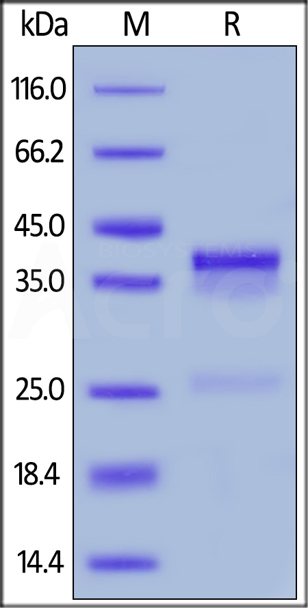 Mouse CTGF, His Tag (Cat. No. CTF-M52Hc) SDS-PAGE gel