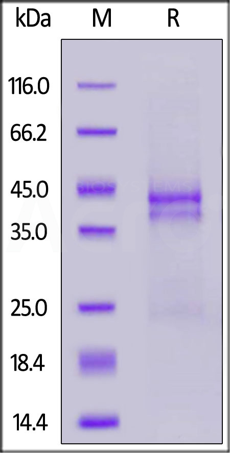 Human CTGF, His Tag (Cat. No. CTF-H52H5) SDS-PAGE gel