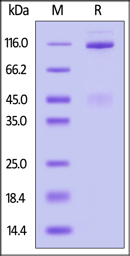 Rhesus macaque HGF R,Fc Tag (Cat. No. MET-R5256) SDS-PAGE gel