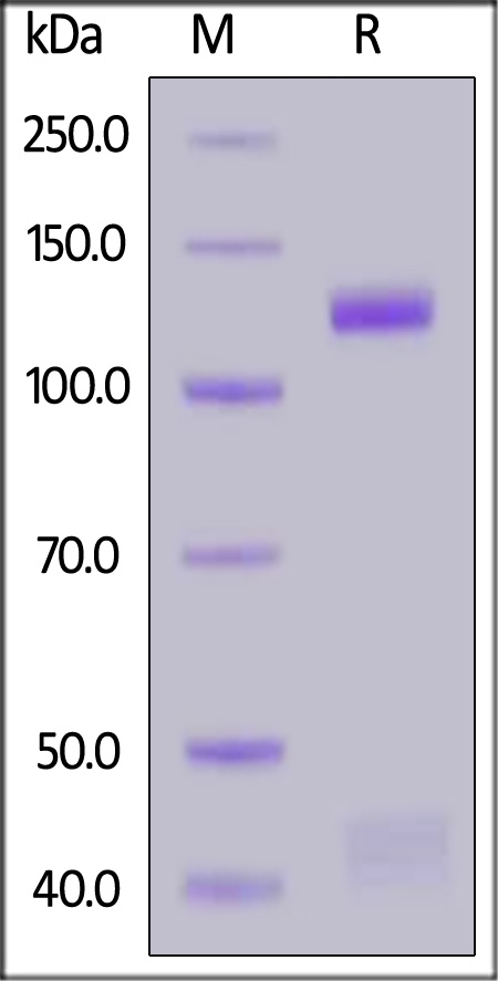 Mouse HGF R, Fc Tag (Cat. No. MET-M5254) SDS-PAGE gel