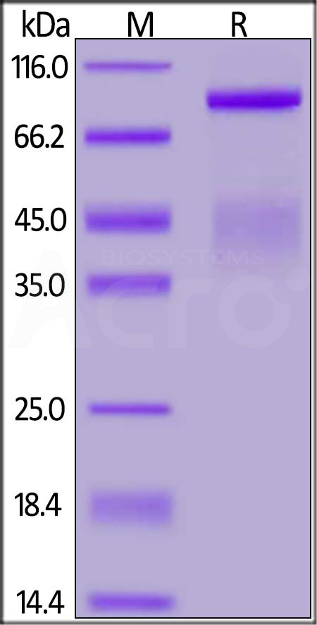 Human HGF R, His Tag (Cat. No. MET-H5227) SDS-PAGE gel