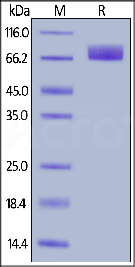 Human PDGF R alpha, His Tag (Cat. No. PDA-H52H7) SDS-PAGE gel