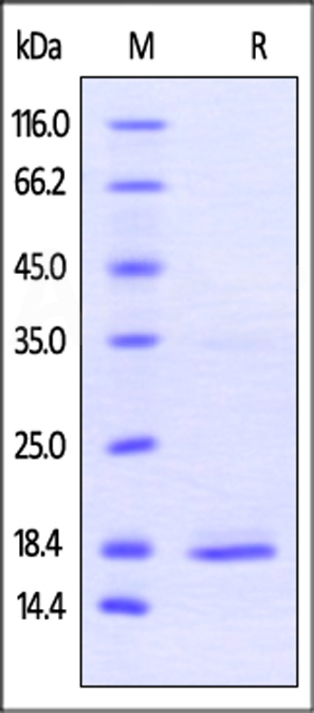 Human TNF-alpha, His Tag (active trimer) (MALS verified) (Cat. No. TNA-H5228) SDS-PAGE gel