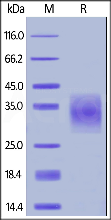 Human TNFR1, His Tag (Cat. No. TN1-H5222) SDS-PAGE gel