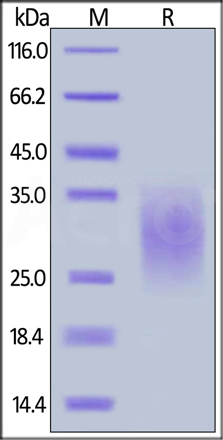 Mouse TRAIL R2, His Tag (Cat. No. TR2-M52H5) SDS-PAGE gel