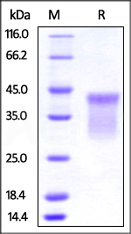 Human HVEM, His Tag (Cat. No. HVM-H52E9) SDS-PAGE gel