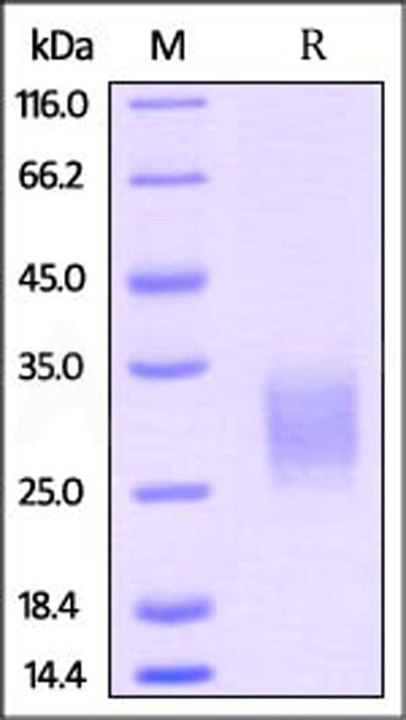 Mouse GITR, His Tag (Cat. No. GIR-M5220) SDS-PAGE gel