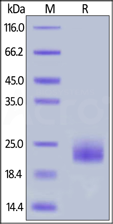 Canine GITR, His Tag (Cat. No. GIR-C52H6) SDS-PAGE gel