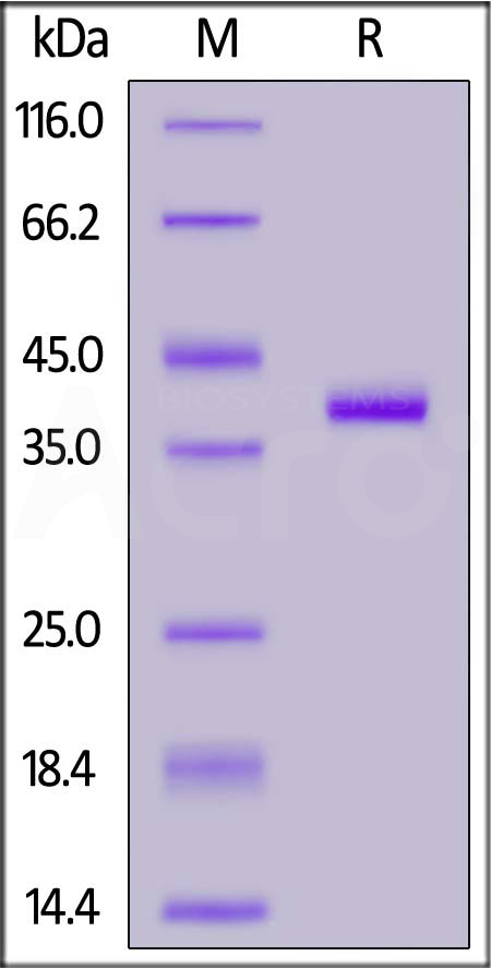Human CCL5, Fc Tag (Cat. No. CC5-H5251) SDS-PAGE gel