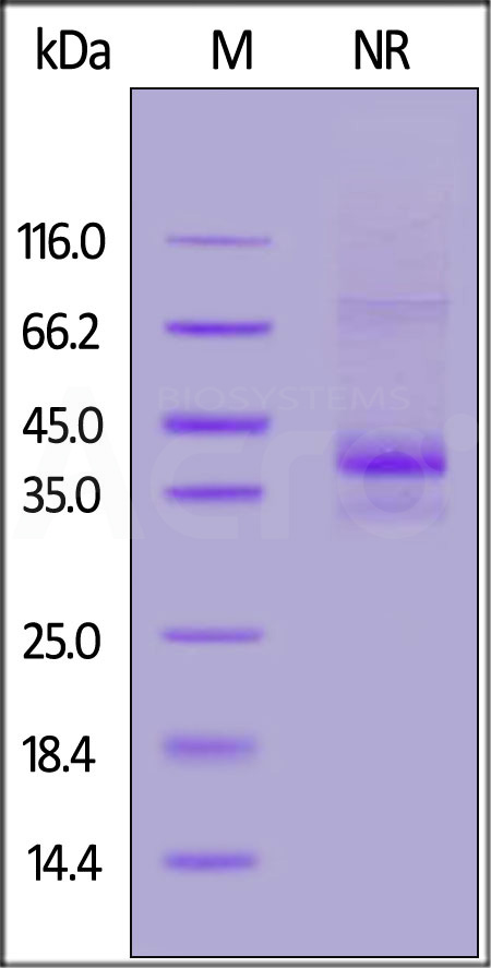 Human CCR5, Flag,His Tag (Cat. No. CC5-H52D1) SDS-PAGE gel