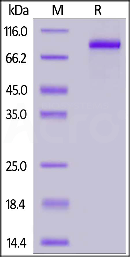 Human G-CSF R, His Tag (Cat. No. GCR-H5223) SDS-PAGE gel
