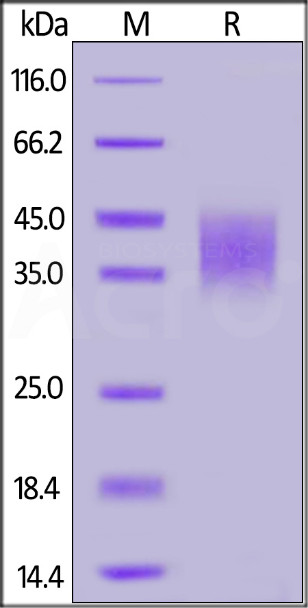 Human IFN-gamma R1, His Tag (Cat. No. IF1-H5223) SDS-PAGE gel
