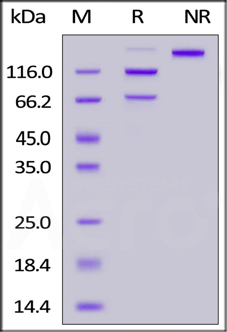 Human Complement C5 (R885H), His Tag (Cat. No. CO5-H52Hx) SDS-PAGE gel