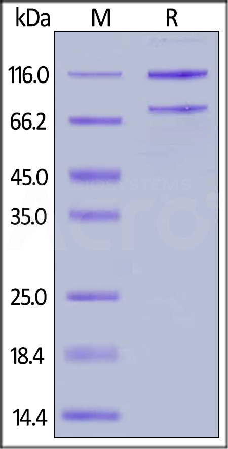 Rat Complement C5, His Tag (Cat. No. CO5-R52H5) SDS-PAGE gel