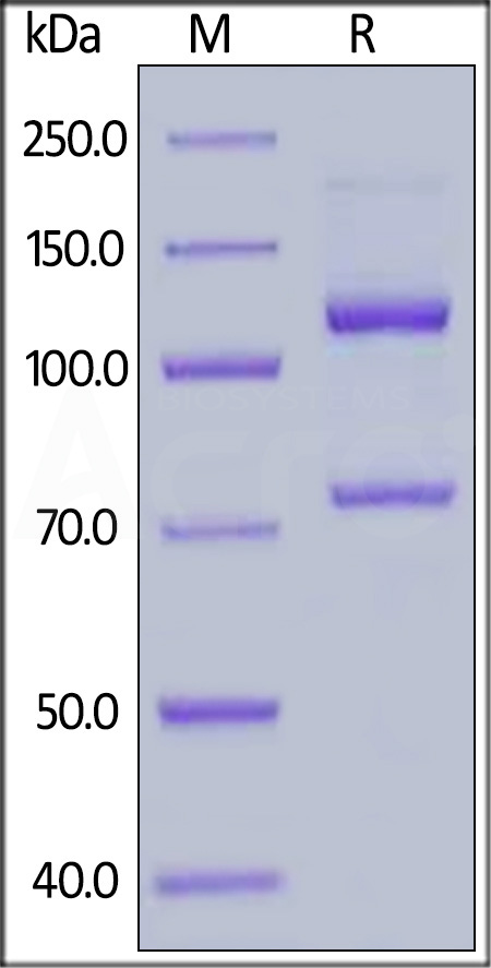Human Complement C5 (w917s), His Tag (Cat. No. CO5-H52H7) SDS-PAGE gel