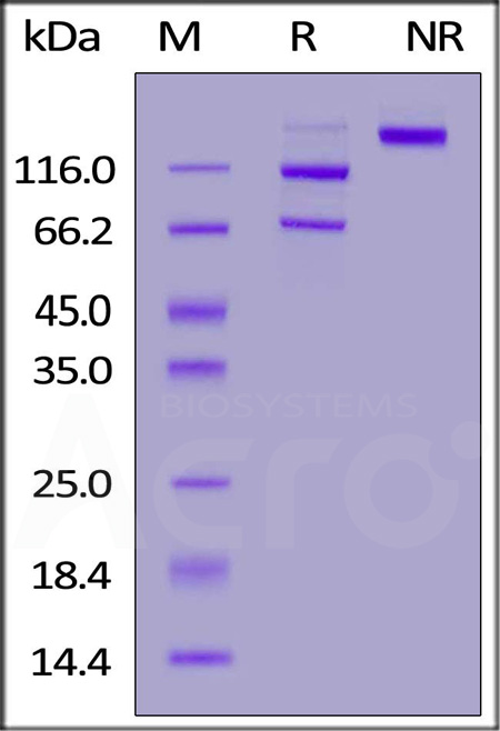 Human Complement C5, His Tag (Cat. No. CO5-H52Ha) SDS-PAGE gel