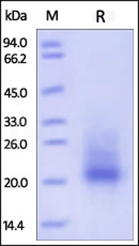 Mouse SCF, His Tag (Cat. No. SCF-M5228) SDS-PAGE gel