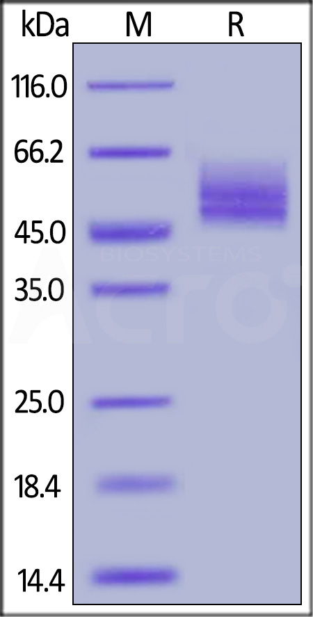 Human CNTF R alpha, His Tag (Cat. No. CNR-H5225) SDS-PAGE gel