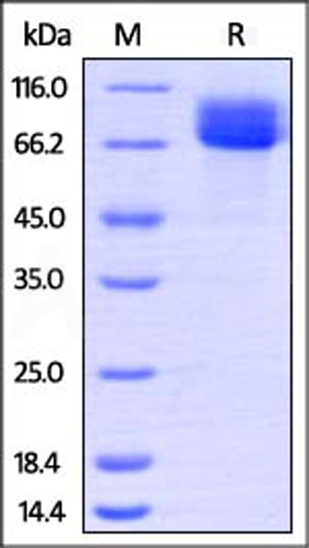 Human CD117, His Tag (Cat. No. CD7-H52H4) SDS-PAGE gel