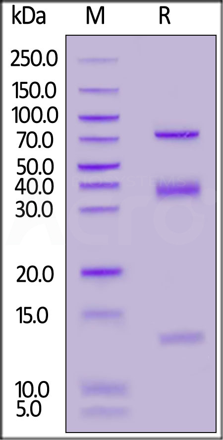 Mouse LRRC32&TGFB1 Heterotrimer protein, His Tag&Tag Free (Cat. No. GA1-M52W2) SDS-PAGE gel