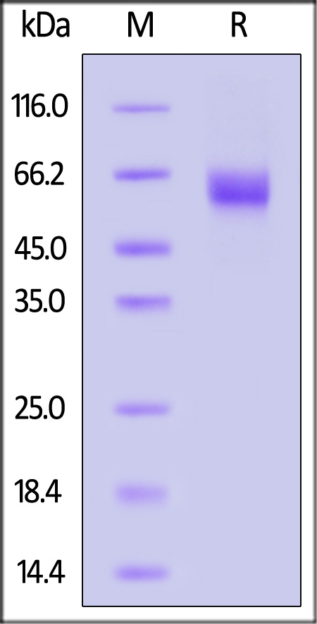 Biotinylated Human IL-1RL1, His,Avitag™ (Cat. No. IL1-H82E9) SDS-PAGE gel