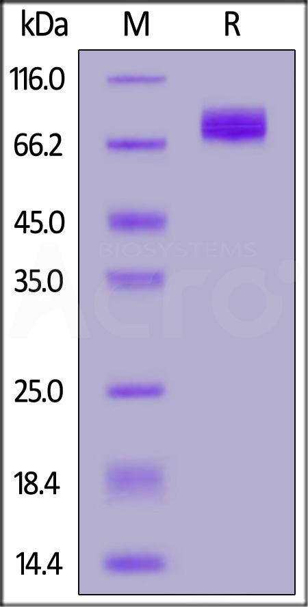 Mouse IL-2RB&IL-2RG Heterodimer Protein, Fc Tag&Fc Tag  (Cat. No. ILG-M5254) SDS-PAGE gel