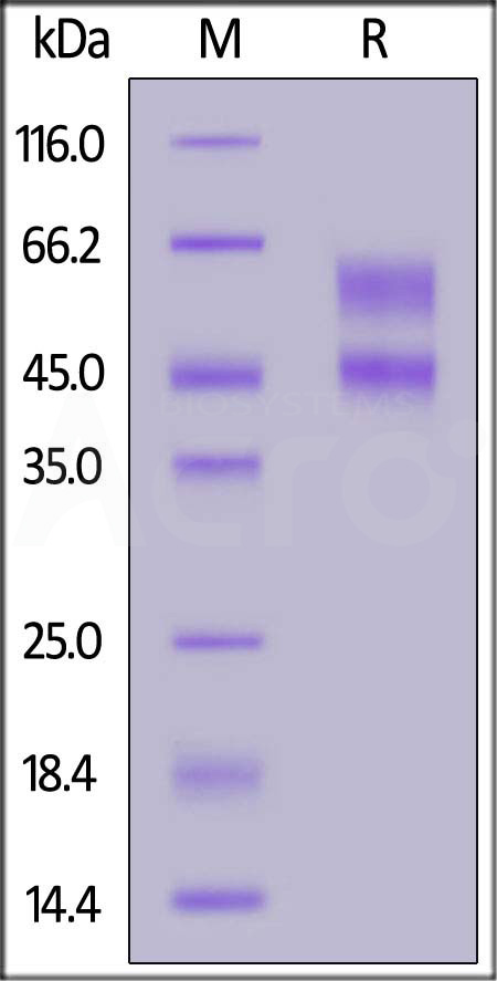 Rat IL-2RB&IL-2RG Heterodimer Protein, His Tag&Twin-Strep Tag (Cat. No. ILG-R5283) SDS-PAGE gel