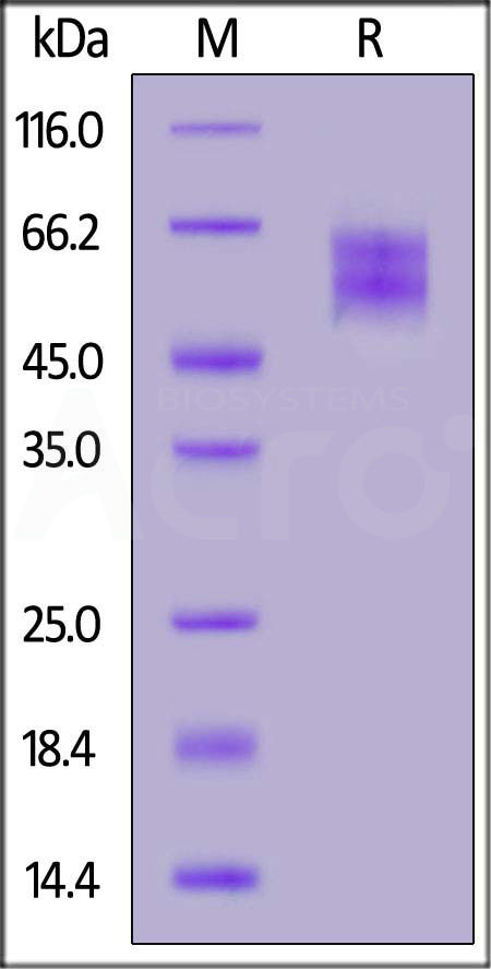 Mouse IL-2RB&IL-2RG Heterodimer Protein, His Tag&Twin-Strep Tag (Cat. No. ILG-M5283) SDS-PAGE gel