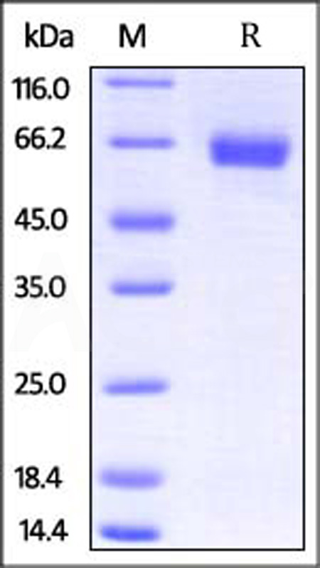 Mouse IL-4 R alpha, Fc Tag (Cat. No. ILR-M5252) SDS-PAGE gel