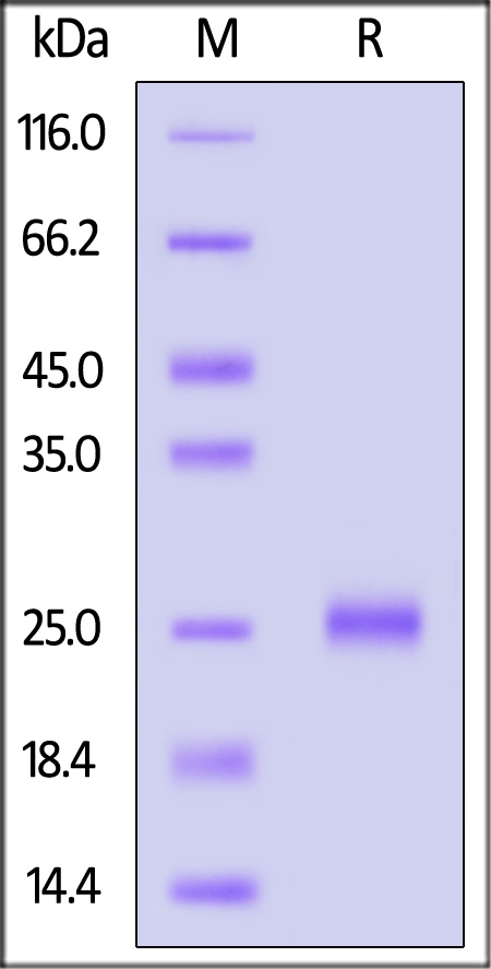 Mouse IL-17C, His Tag (Cat. No. ILC-M52H7) SDS-PAGE gel