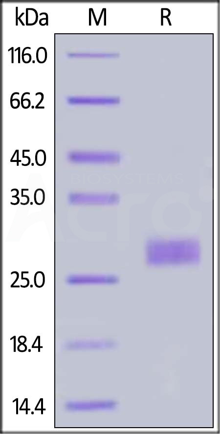 Human IL-33, His Tag (Cat. No. IL3-H52H7) SDS-PAGE gel