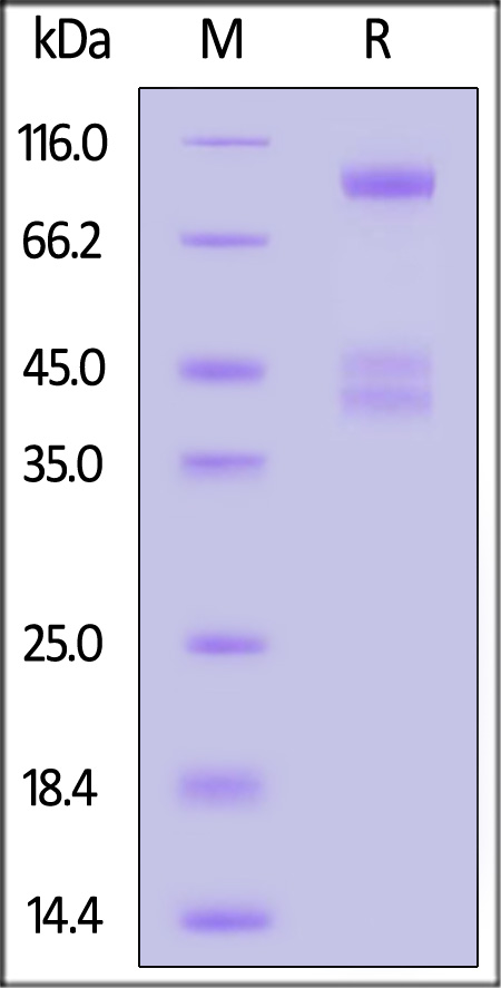 Biotinylated Human IL-2RB&IL-2RA&IL-2RG, His,Avitag&Twin Strep Tag (Cat. No. ILG-H82W9) SDS-PAGE gel