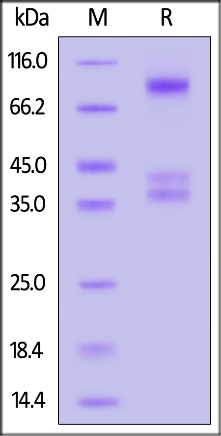 Human IL-2RB&IL-2RA&IL-2RG, His Tag&Twin Strep Tag (Cat. No. ILG-H52W9) SDS-PAGE gel
