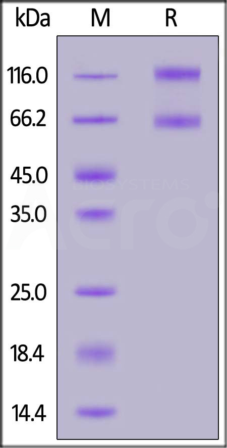 Biotinylated Cynomolgus IL-2RB&IL-2RA&IL-2RG, Fc,Avitag&Fc,Avitag (Cat. No. ILG-C82F6) SDS-PAGE gel