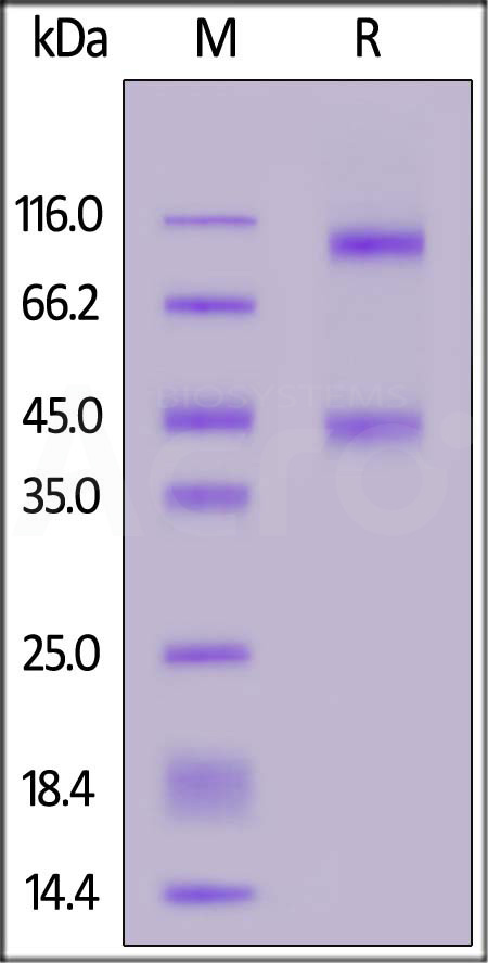 Rat IL-2RB&IL-2RA&IL-2RG, His Tag&Twin-Strep Tag (Cat. No. ILG-R5223) SDS-PAGE gel