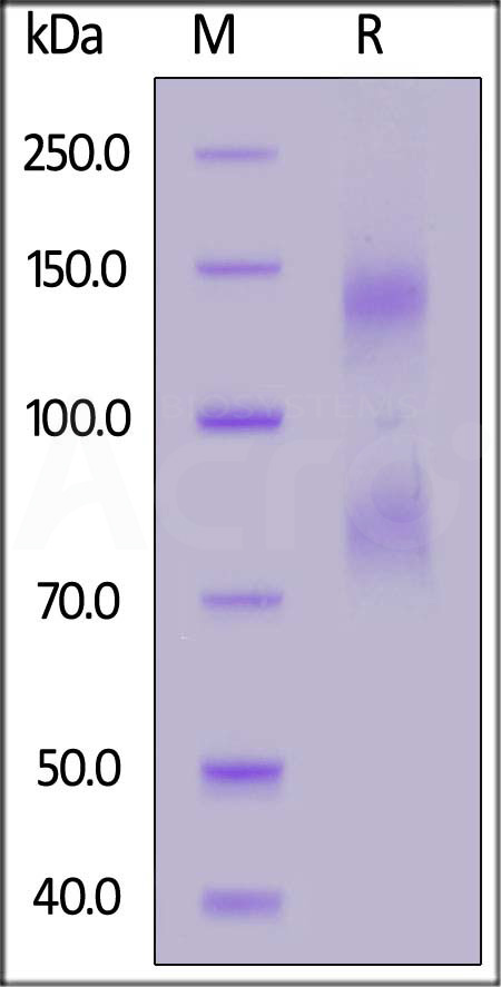 Mouse IL-2RB&IL-2RA&IL-2RG, Fc Tag&Fc Tag (Cat. No. ILG-M5253) SDS-PAGE gel