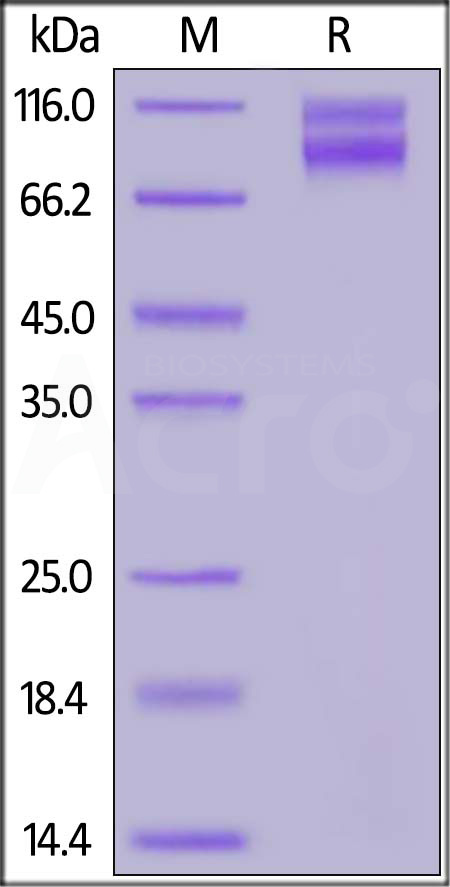 Human IL17RA & IL17RC Protein, Fc Tag&Fc Tag (Cat. No. ILC-H5257) SDS-PAGE gel