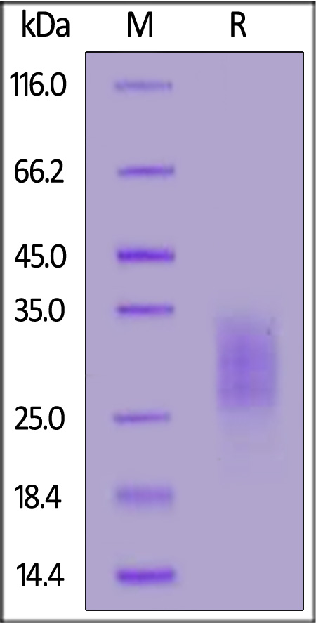 Mouse IL-3 Protein, His Tag (Cat. No. IL3-M52H8) SDS-PAGE gel