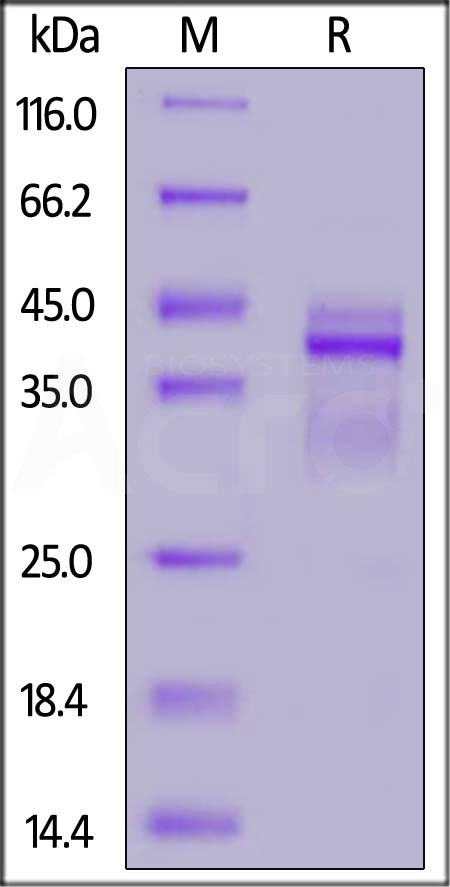 Human IL-12B&IL-12A Heterodimer Protein, His Tag&Flag Tag (Cat. No. IL2-H4210) SDS-PAGE gel