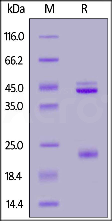 Human IL-23A & Rat IL-12B Heterodimer Protein, His Tag&Tag Free (Cat. No. ILB-HR52W3) SDS-PAGE gel