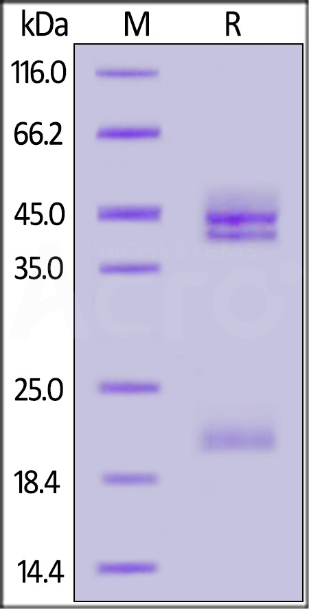 Cynomolgus IL-23A & Mouse IL-12B Heterodimer Protein, His Tag&Tag Free (Cat. No. ILB-CM52W8) SDS-PAGE gel