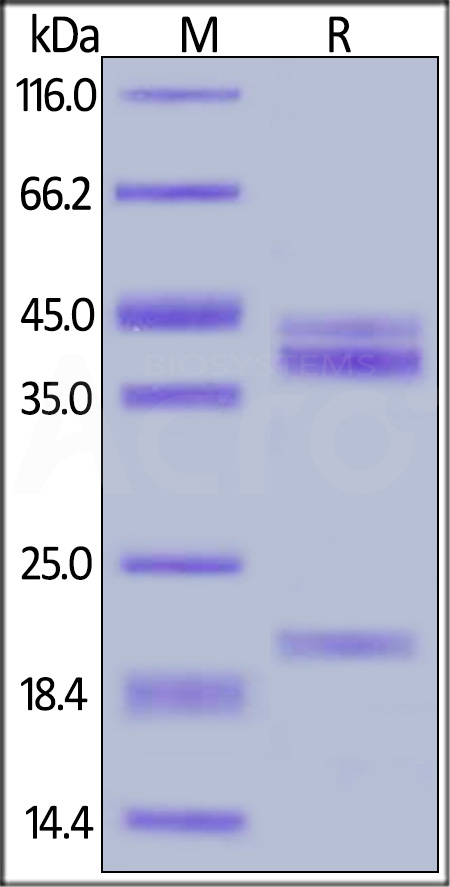 Human IL-23A&IL-12B Heterodimer Protein, His Tag&Tag Free (Cat. No. ILB-H52W5) SDS-PAGE gel